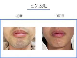 ホワイトニング/脱毛 専門店エクシア岡崎店のその他イメージ