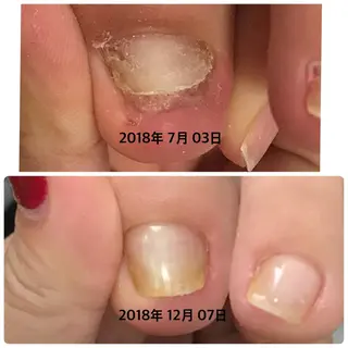 ネイル Lotus Nailのネイルデザイン