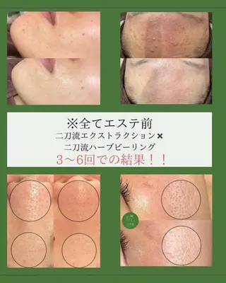 Le'perle｡所属・Le'perle｡ Kyokaのエステ・リラクイメージ