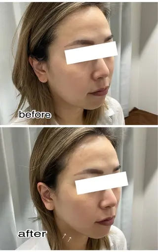 ENCHANT Kaede/肌質改善のその他イメージ