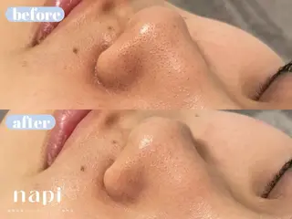 ハーブピーリング 専門店napiのエステ・リラクイメージ