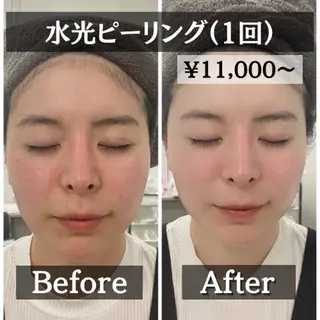 【肌質改善・リフトアップ専門店】セラピックエステ美極所属・羽賀 茉衣子のエステ・リラクイメージ