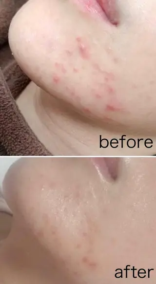 skinity所属・ピーリング専門サロン skinityのエステ・リラクイメージ