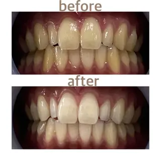 メンズ ホワイトニング ショップ本八幡店のエステ・リラクイメージ