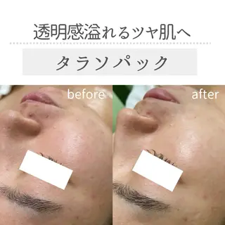 デ・アイム新潟北所属・サイトウ .のエステ・リラクイメージ