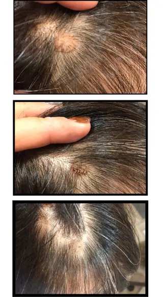 nouvelle  plume所属・ヌーベル プリュムのエステ・リラクイメージ