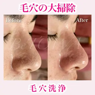 BeTOWA所属・BeTOWA 毛穴洗浄/Wax脱毛のエステ・リラクイメージ
