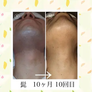 Belle ＋vi（ベル）のその他イメージ