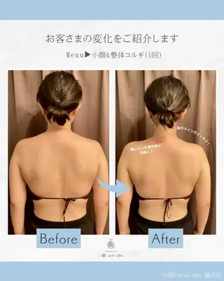 小顔Face Labo藤沢店所属・小顔フェイスラボ藤沢 山内萌香のエステ・リラクイメージ