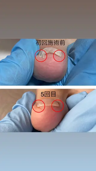 ネイル Estotibi エストティビのその他イメージ