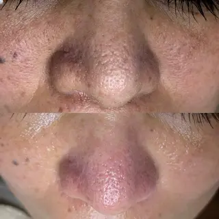 毛穴ケア・ヘッドスパサロンSHINY(シャイニー)所属・毛穴ケア・ヘッドスパ サロンSHINYのエステ・リラクイメージ