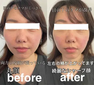 美容鍼灸サロン mahoroba院長のエステ・リラクイメージ