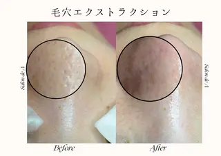 Salon de A所属・【美肌専門店】 Salon de Aのエステ・リラクイメージ
