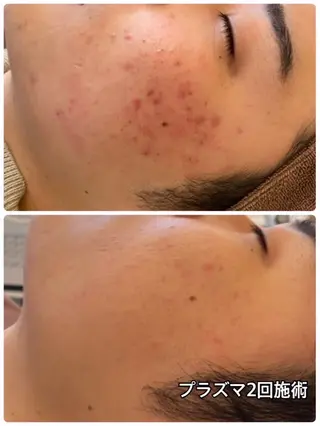 EARTH coiffure beaute 小山店所属・EARTH 小山店 shimaのエステ・リラクイメージ