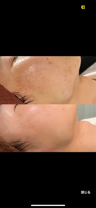 LEPUS【レプス】 sekiのエステ・リラクイメージ