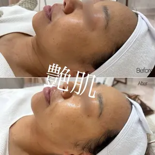 〈etre〉トータルビューティーサロン所属・etre - 韓国肌管理 -のエステ・リラクイメージ