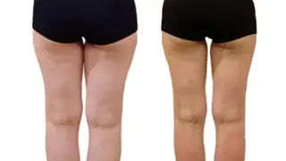 ダイエット専門エステ トレントのエステ・リラクイメージ