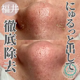 毛穴肌質ケアサロン Yourmeユアミーのエステ・リラクイメージ