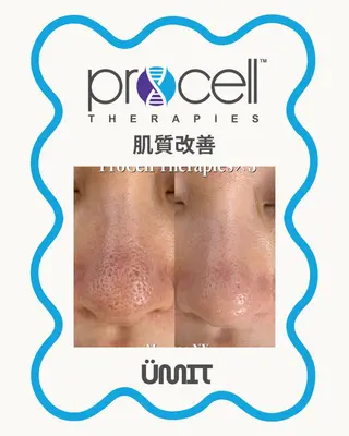 Ümit（ユミト） プロセルセラピーズのネイルデザイン