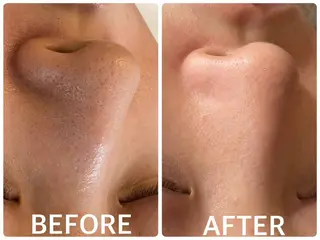 ハーブピーリング 🌿京橋のエステ・リラクイメージ