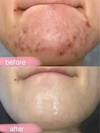 西区九条エステ MITUREIサロンのエステ・リラクイメージ