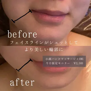 肌質改善サロン🌻 Nico laughのエステ・リラクイメージ