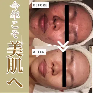 ミュージック＆オーガニックエステShalom5〜シャロームファイブ〜所属・オーガニックエステ Shalom5のエステ・リラクイメージ