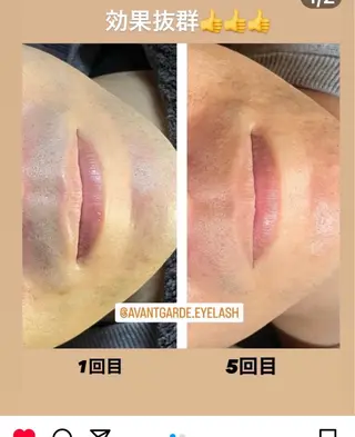 メンズ 【an.g（アン.ジー）】脱毛/フェイシャル/痩身所属・フェイシャル/脱毛 an.gアン.ジーのエステ・リラクイメージ