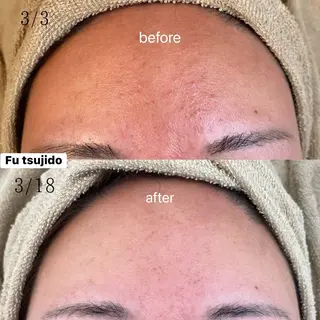 メンズ キッズ ネイル Fu 辻堂店のネイルデザイン