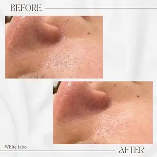 White labo 今村のエステ・リラクイメージ