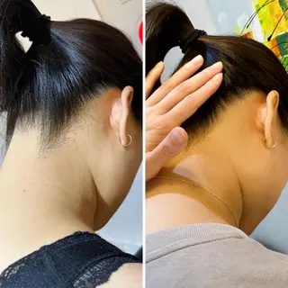 うなじ脱毛/美肌脱毛 LABELのエステ・リラクイメージ