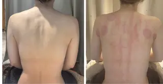 moonlit.所属・moonlit. 田上りかのエステ・リラクイメージ