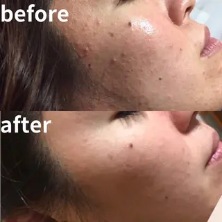 痩せるハーブ蒸し／ 温活サロン imuaのエステ・リラクイメージ