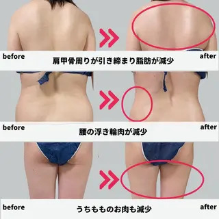 ダイエット／脱毛 美顔／フォト／ハーブのその他イメージ