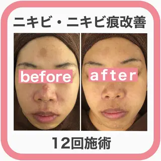 ミディアム カラー パーマ ヘアアレンジ メンズ キッズ ネイル マツエク・マツパ ニキビ・肌質改善専門 ♡人生が変わるサロンのエステ・リラクイメージ