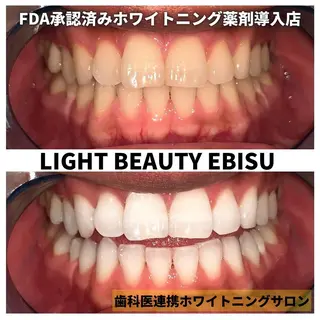 ライトビューティー 恵比寿店のその他イメージ