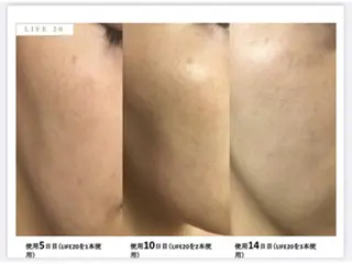 トラブル肌専門店 PLACE梅田堂山店のエステ・リラクイメージ