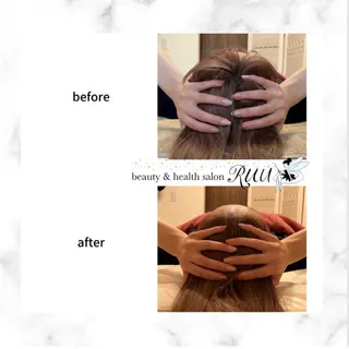 【頭痛、睡眠改善】 salon RUUのエステ・リラクイメージ