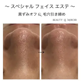 ビューティー ミロワールのエステ・リラクイメージ