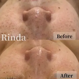 ブライダル痩身×脱毛 尼崎駅前サロンのエステ・リラクイメージ