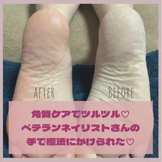 ネイル LOKA-HULU  ロカフルのマツエク・マツパデザイン