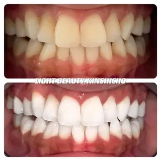 メンズ ライトビューティー 錦糸町店のエステ・リラクイメージ