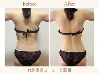 あみ|痩身の最先端 よもぎ蒸しサロン大塚のエステ・リラクイメージ