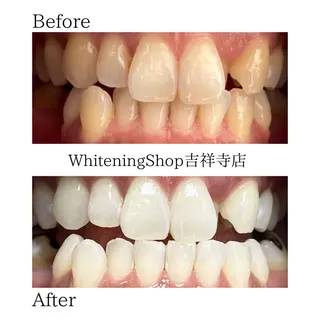 ホワイトニング ショップ吉祥寺店のエステ・リラクイメージ