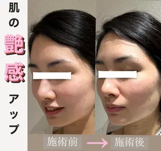 脱毛&美容サロンBLUESEA所属・脱毛&美容サロン BLUESEAのエステ・リラクイメージ