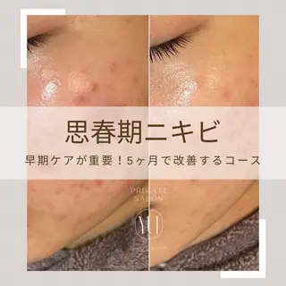 1ヶ月後も半分残る 高持続LEDエクステのマツエク・マツパデザイン