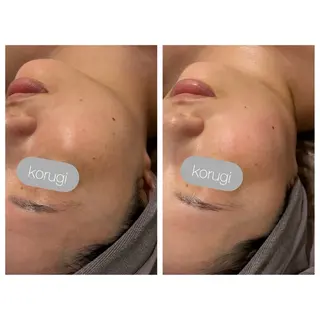 ☆痩身/小顔☆ コルギのエステ・リラクイメージ