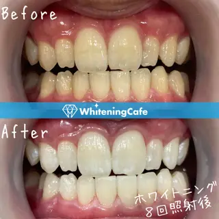 ホワイトニングカフェ神戸元町店所属・ホワイトニングカフェ 神戸元町店のエステ・リラクイメージ