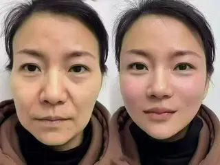 マツエク・マツパ aliaハイフ&水光ジェットサロン所属・aliaハーブ水光店 エステティシャン募集のエステ・リラクイメージ