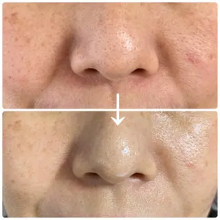 デアイム高島平所属・兼松 美香のエステ・リラクイメージ